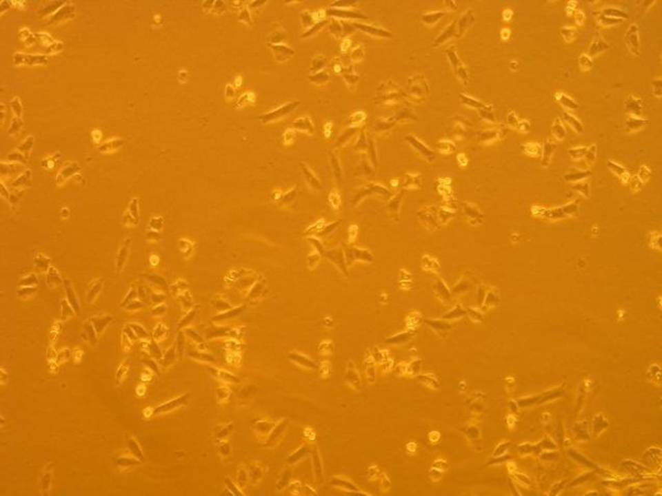 NEPA21 / CHO - Chinese Hamster Ovary cells - Viability 74 per cent